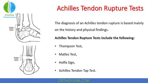 test for achilles tendon tear|special tests for achilles tendon.